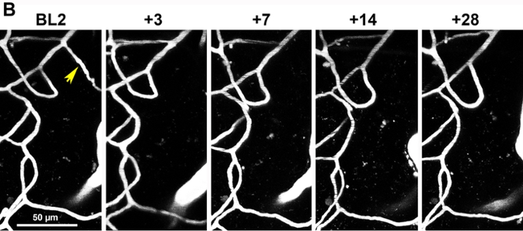 long-term imaging of vessels